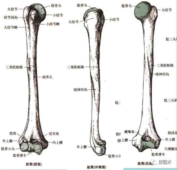 盂肱关节半脱位由什么造成：典型体征、多发生情况及前脱位分析