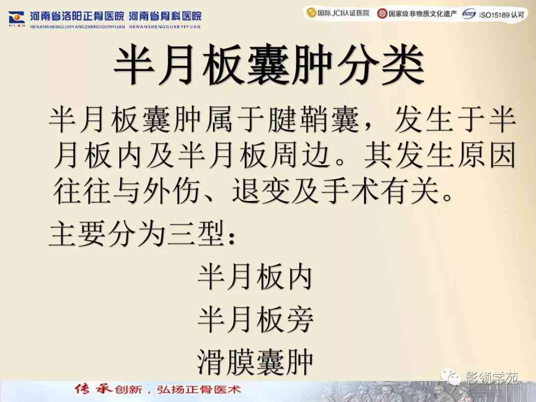 盘状半月板不认定工伤