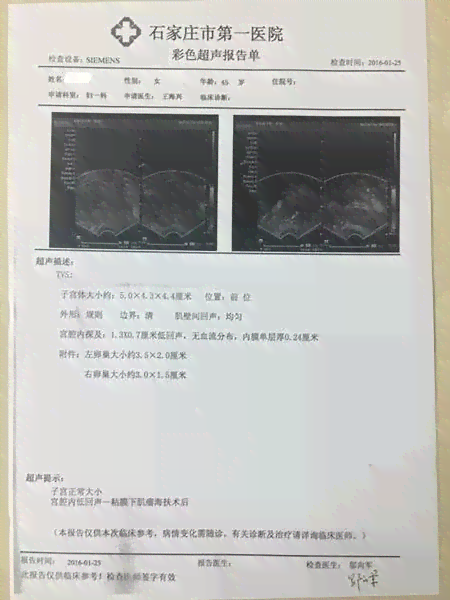 分享宝宝三维彩超照：见证生命的奇迹，感受爱的度