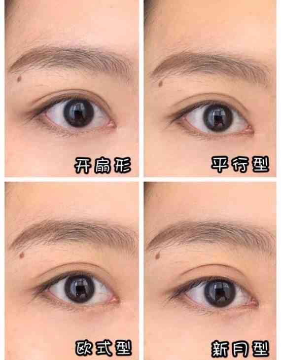 眼皮缝两针属于什么伤情鉴定：眼皮缝两针算何种伤害级别鉴定标准