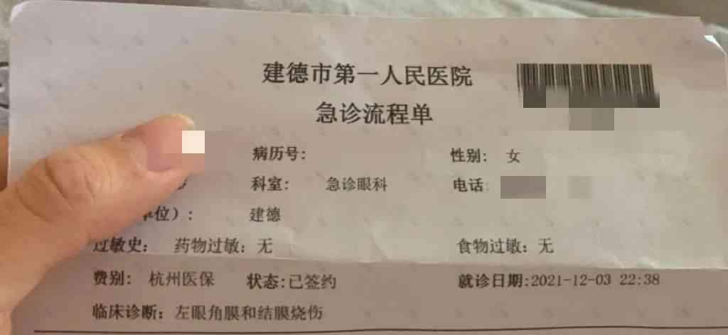 眼睛化学烧伤能认定工伤吗：工伤鉴定标准及赔偿金额与烧伤级别划分