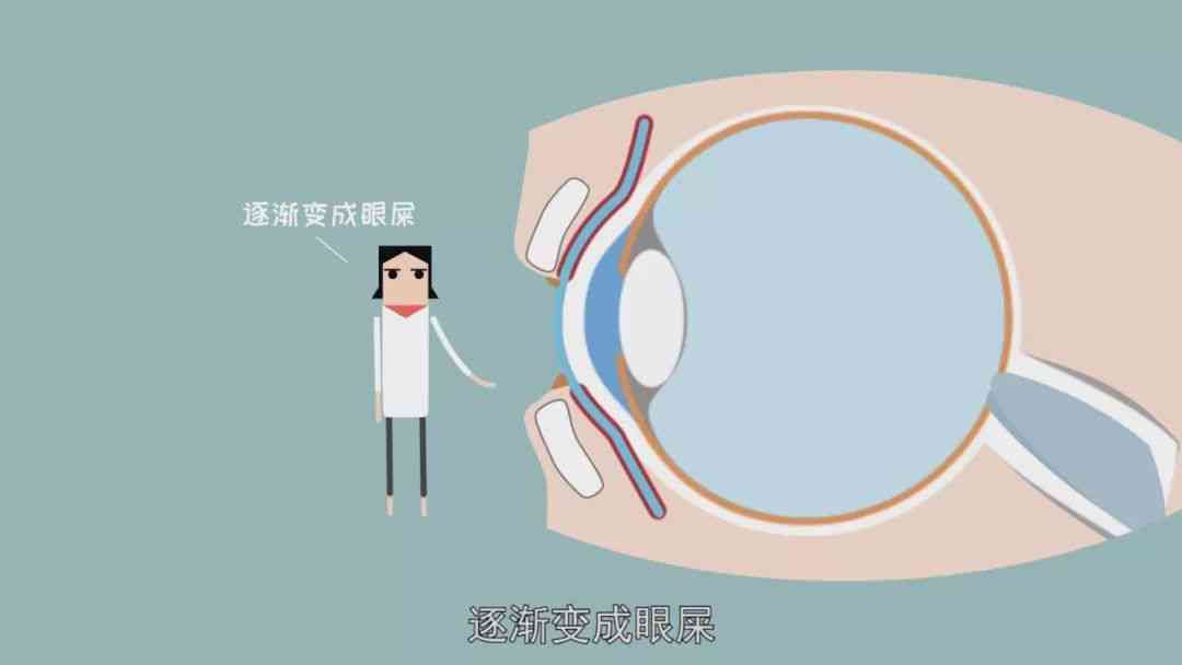 眼睛进铝屑怎么认定工伤