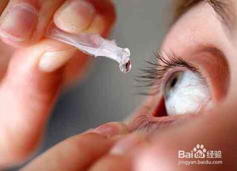 如何处理眼部异物的全面指南：铁屑进入眼睛的正确处理方法与急救措