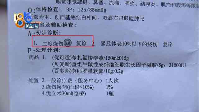 眼睛化学烧伤后定工伤几级及赔偿标准、鉴定方法、治疗用药与恢复时间解析