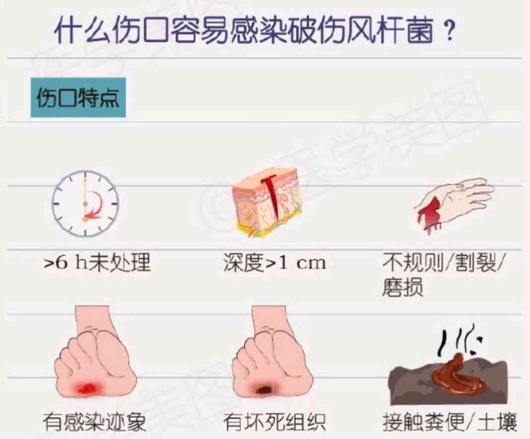 破伤风无法认定工伤怎么办