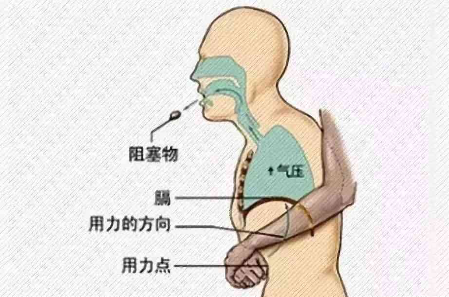 如何快速有效处理碰撞导致的肿胀：全方位消肿技巧与建议