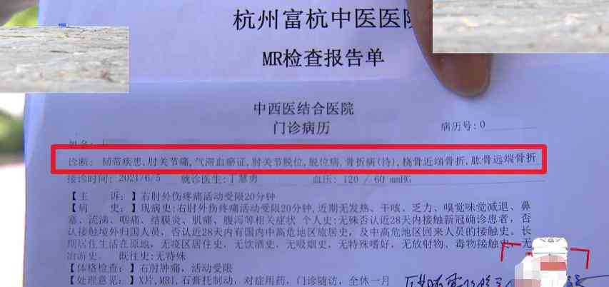 工伤赔偿指南：私人工地受伤如何进行合理索赔