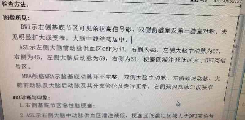 突发疾病途中回家被认定工伤：详解认定标准与流程及常见疑问解答
