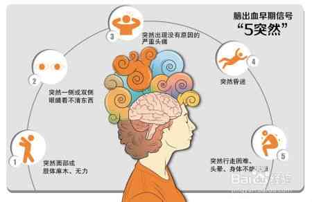 突发脑出血算不算意外保险理赔范围内的重大疾病或？