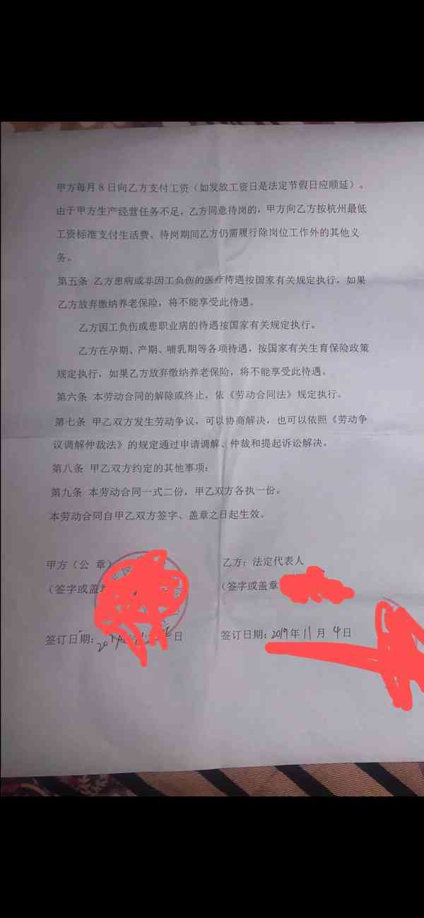 工伤赔偿详解：签订劳务合同后工伤的赔偿项目及标准