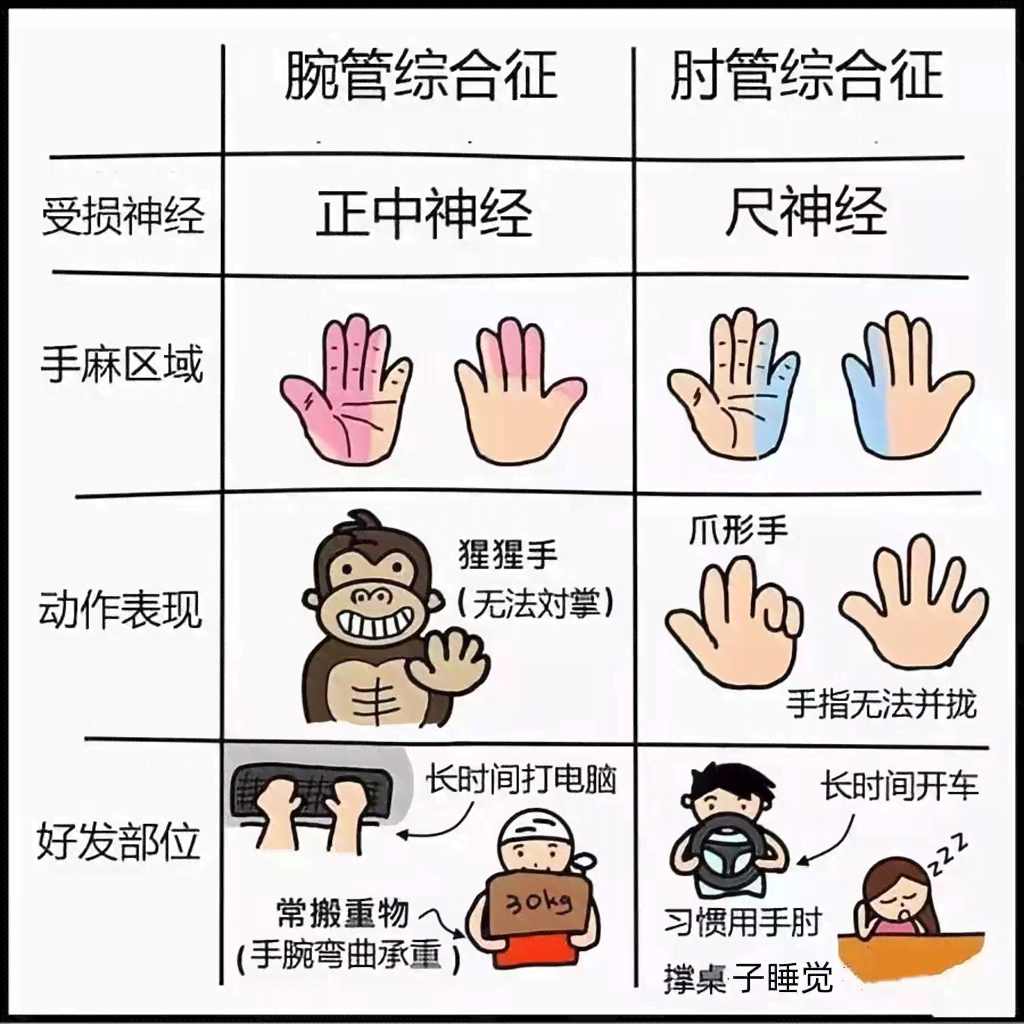 管腕综合征怎样认定工伤