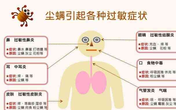 粉尘过敏算工伤吗：严重后果与持续时间，是否会致死，对身体危害及症状详解