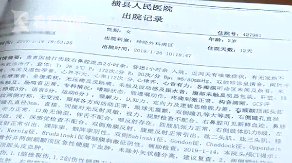 精神病患者在工作中受伤的工伤认定标准与条件详解