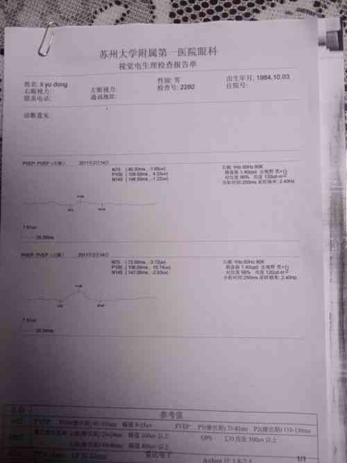 体检报告A含义解析：深度解读体检结果背后的意义