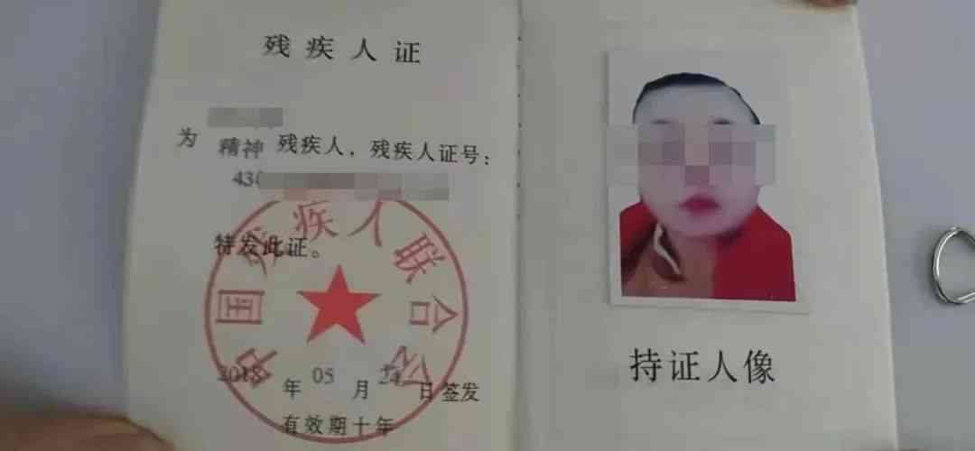 糖尿病足残疾等级评定详解：从症状分级到残疾证办理指南