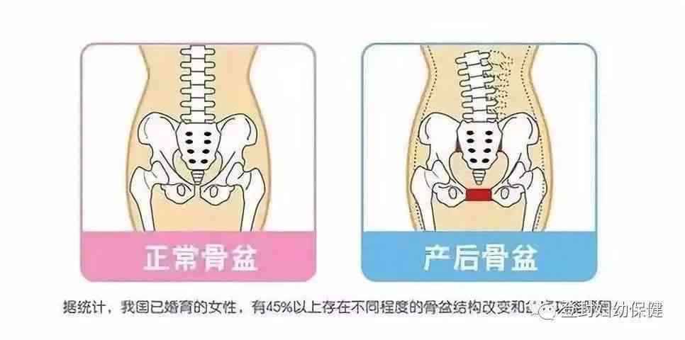 纤维环断裂：探讨修复可能性与恢复策略