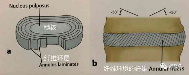 纤维环断裂可以认定工伤吗