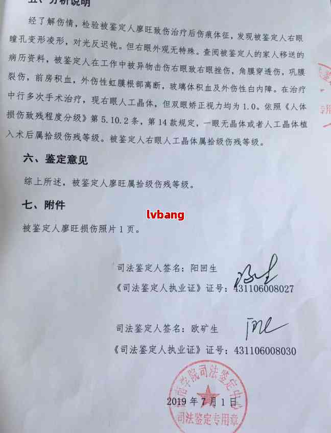 鉴定中心 绍兴工伤鉴定咨询电话查询
