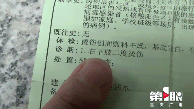 工伤认定标准及缝合伤口赔偿金额详解：缝2针是否算工伤及赔偿细节分析