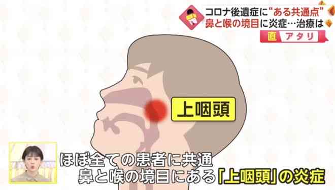 轻微工伤：仅缝2针能否被正式认定为工伤？
