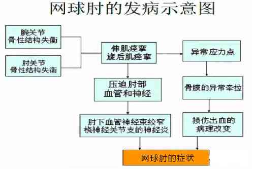 网球肘能否被认定为工伤：申请条件、流程及常见疑问解答