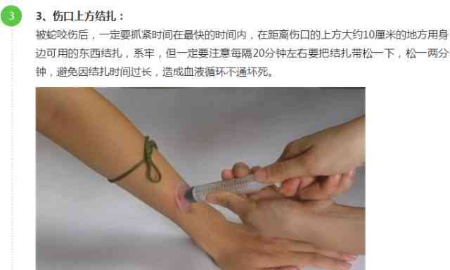 网球肘能否被认定为残疾：症状、治疗及社会福利详解