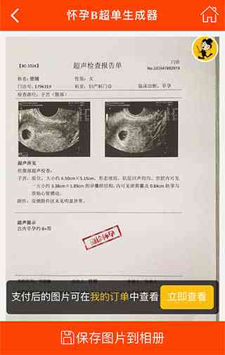 一键在线生成逼真怀孕报告单工具