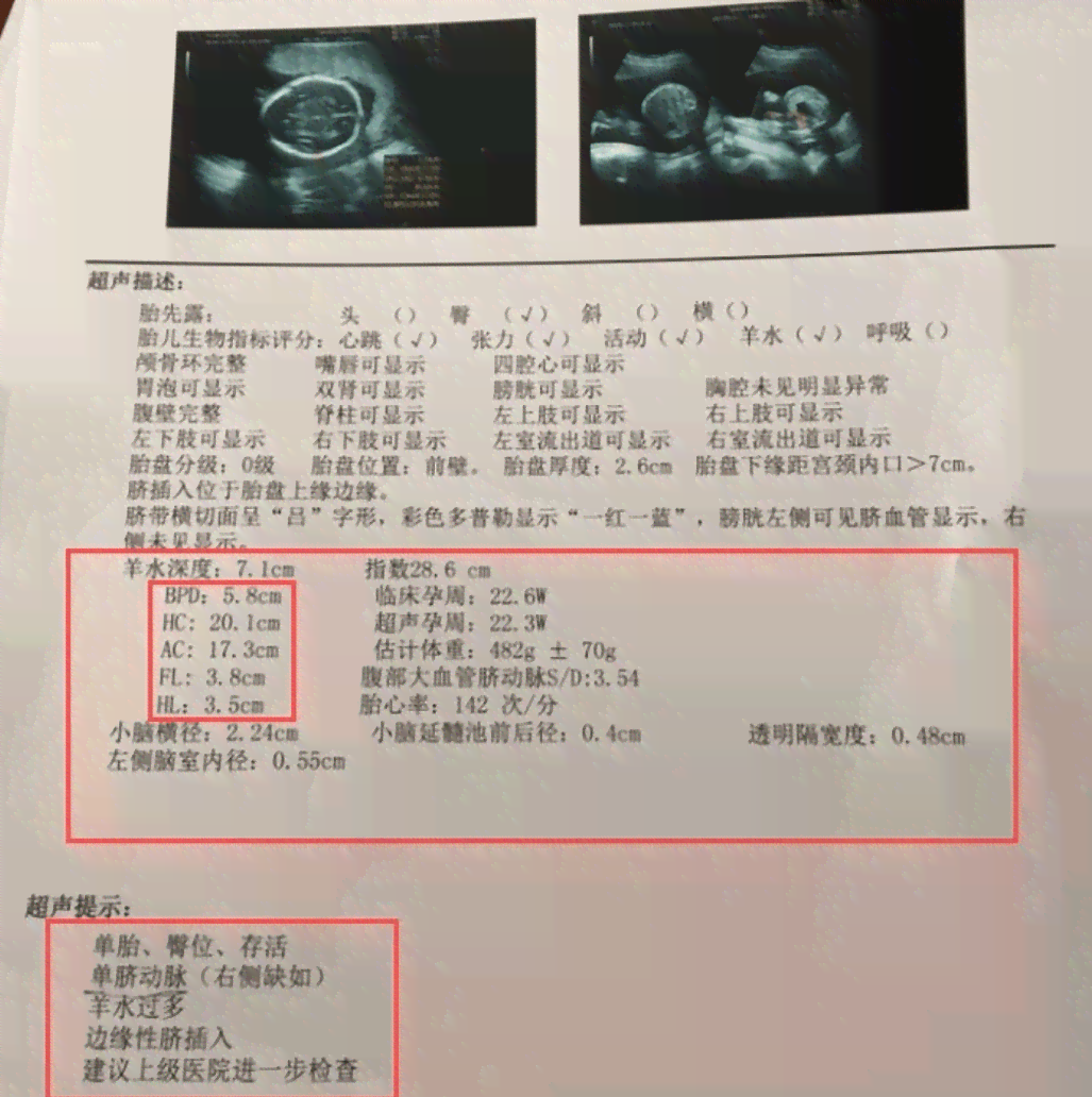孕期全息检查报告单详解：解读各项指标与注意事项