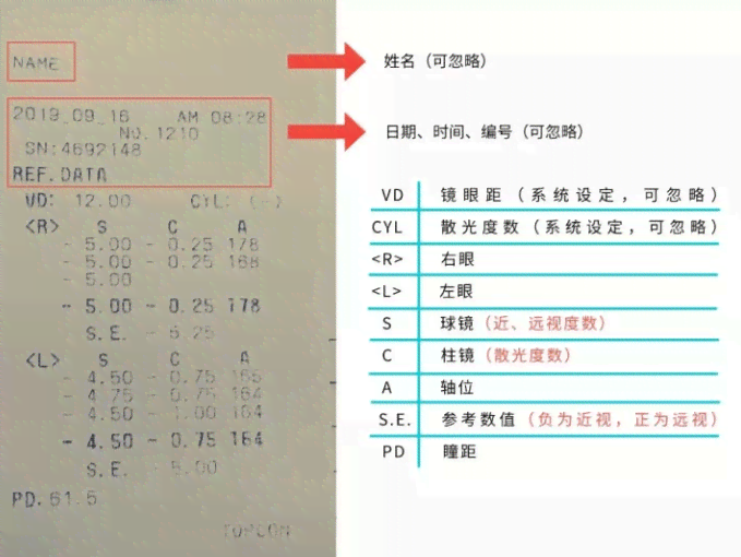 体检报告AI解读是什么意思及Array含义解析