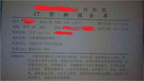 工作肋骨断了两根可以评等级：工伤几级及是否可评残