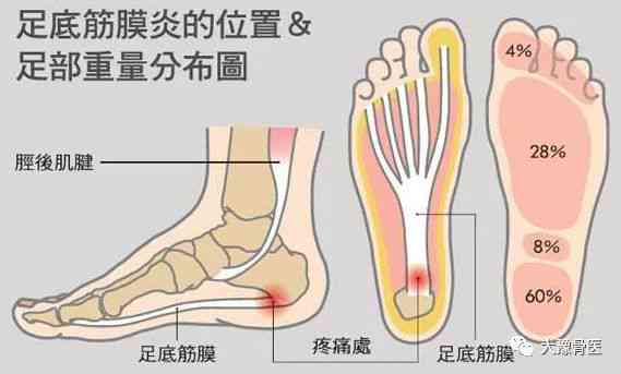 肌筋膜炎治疗费用：哪些医疗项目可享受医保报销待遇？