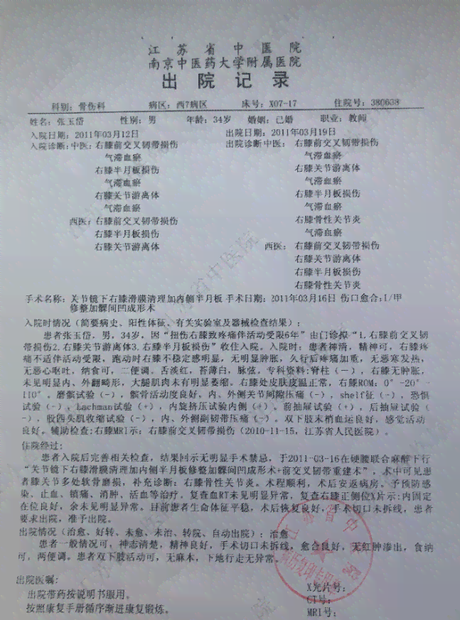 肌肉萎缩伤残等级鉴定：详解其伤残级别划分标准