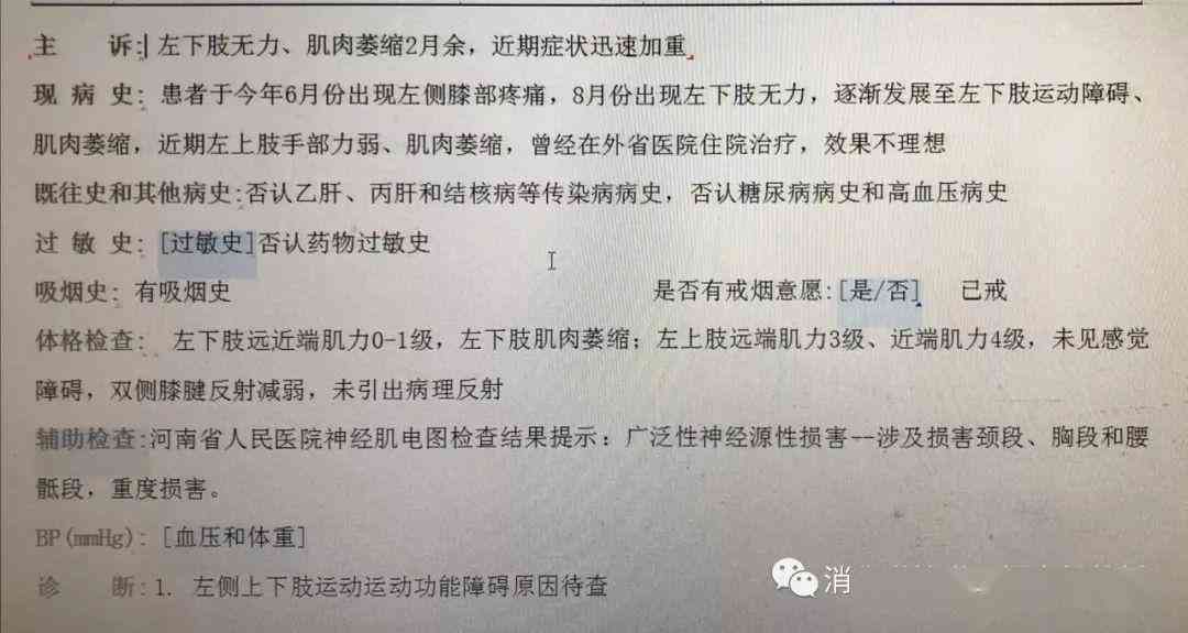 肌肉萎缩鉴定构成伤残级别吗：多少钱及如何进行伤残鉴定