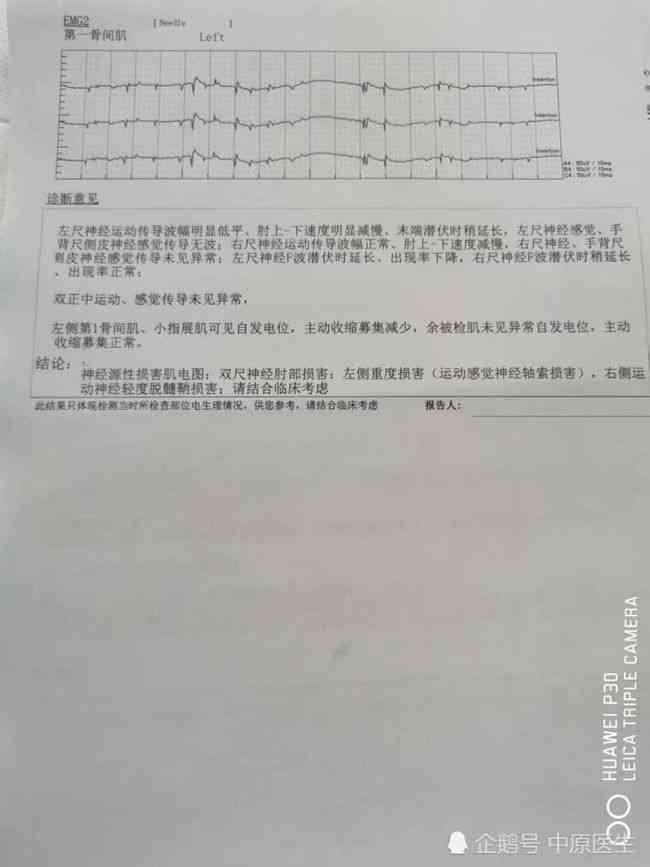 肌肉萎缩患者是否可申请伤残等级鉴定