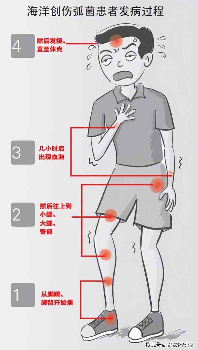 肌腱损伤更高评几级工伤及伤残等级判定标准