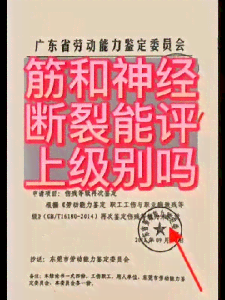 工伤肌腱断裂如何进行伤残等级评定与认定