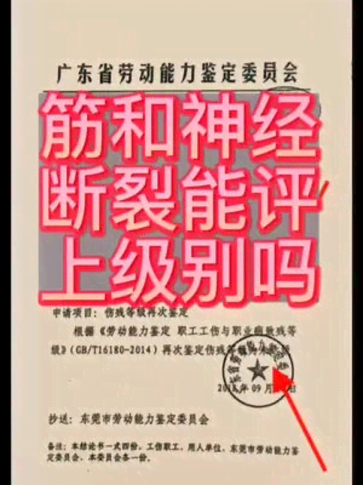 肌腱断裂能否认定工伤等级