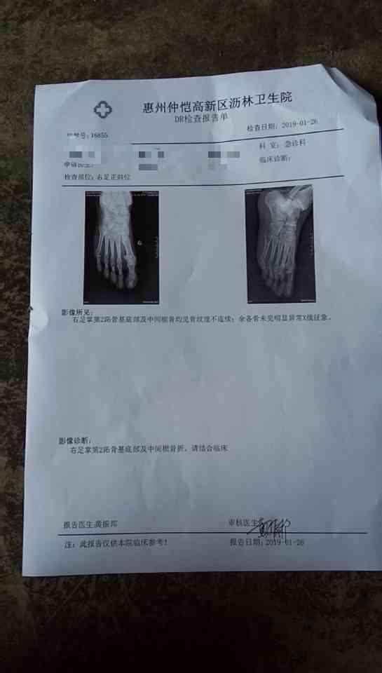 探讨肛瘘病例在工伤伤残认定中的合理性