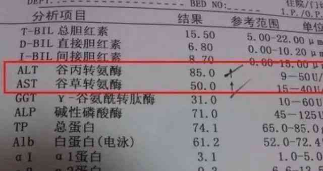 肝损能认定工伤吗：肝损伤工伤认定与赔偿标准解读