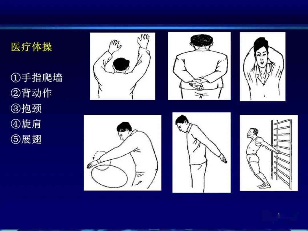 肩关节炎的严重性评估与全面治疗指南：症状、诊断、治疗及预防措