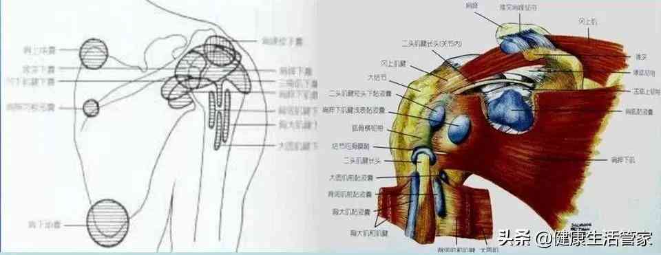 肩关节积液精准鉴别：综合解析与常见病症对比诊断要点