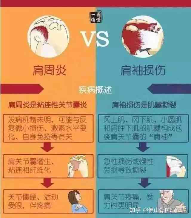 肩袖损伤可以认定工伤吗