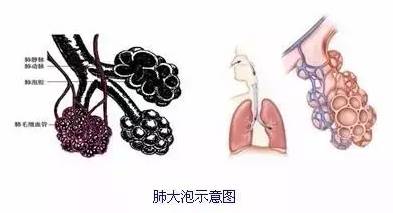 肺大泡是否属于职业病：全面解读职业性肺病分类与认定标准