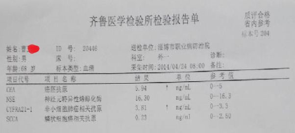 肺部感染能否被认定为工伤：详解工伤认定标准及案例分析