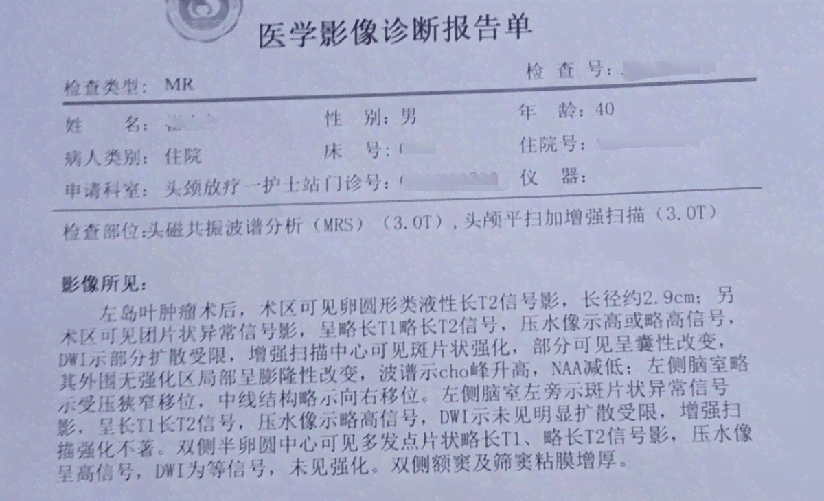 肺癌可以申请工伤吗：工人患肺癌能否报工伤及申请职业病赔偿探讨