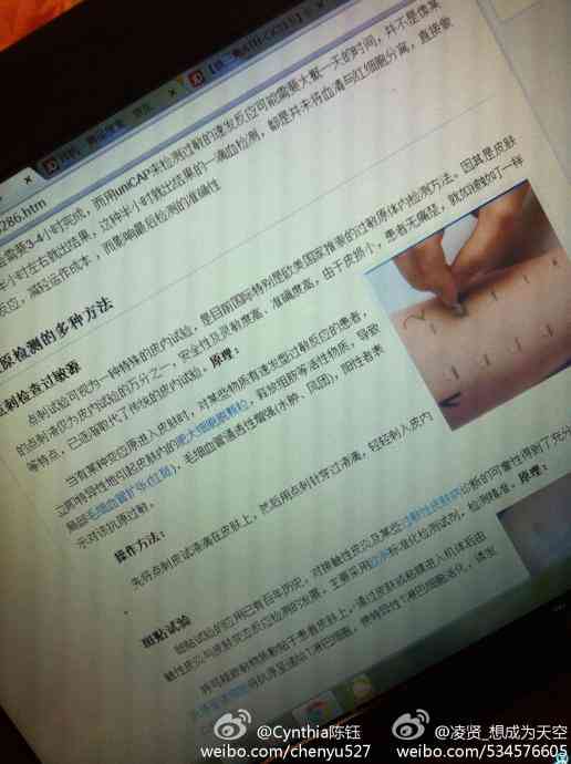 探讨肺结核患者是否合工伤保险理赔条件