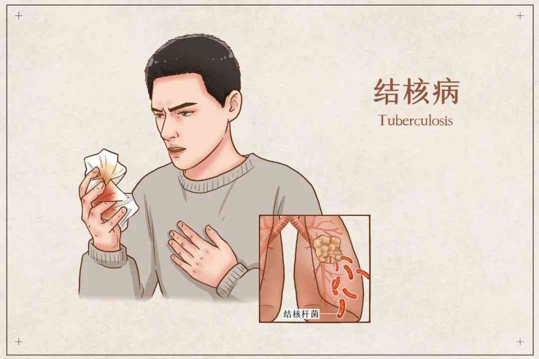 肺结核能否认定工伤伤残等级及肺结核工伤认定条件