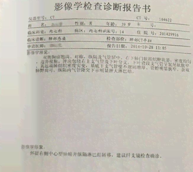 工伤认定：肺部结节是否合工伤标准？