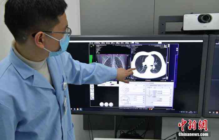 肺部感染复后入职体检标准及健指导：如何安全回归工作岗位