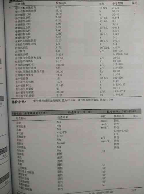 肾囊肿患者入职体检常见疑问解答及就业指导